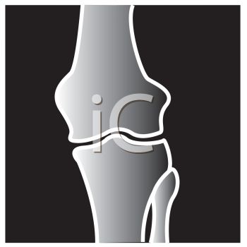 Royalty Free Clip Art Image  Cartoon Carx Ray Of A Knee Joint