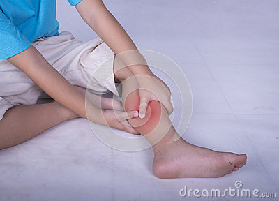 Leg Pain Child Holding Sore And Painful Muscle Sprain Or Cramp Ache