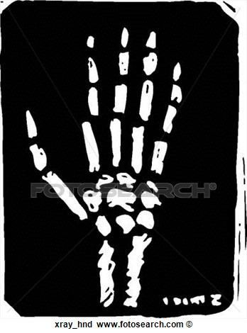 Clipart   X Ray Hand  Fotosearch   Search Clip Art Illustration