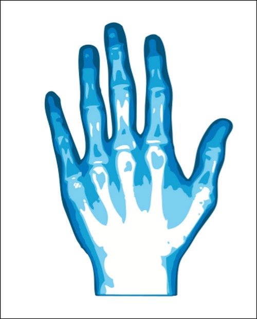Hand X Ray Clipart Images   Pictures   Becuo