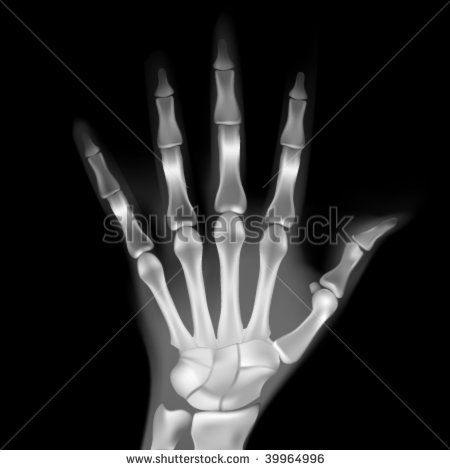 Hand X Ray Clipart Vector X Ray Hand