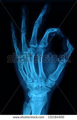 Hand Xray Image Medical Background   Stock Photo