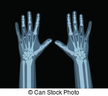 Xray Vector Clipart And Illustrations