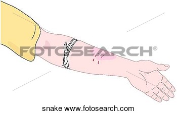 Clipart Of Snake Bite Snake   Search Clip Art Illustration Murals