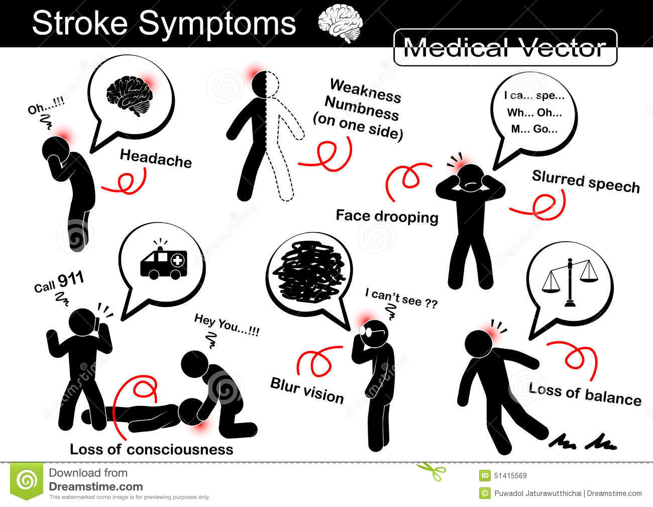 Stroke Symptoms Headache Weakness Numbness One Side Face Drooping