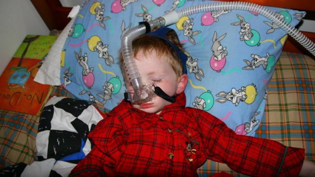 Child With Obstructive Sleep Apnea Uses Cpap During Night Sleep