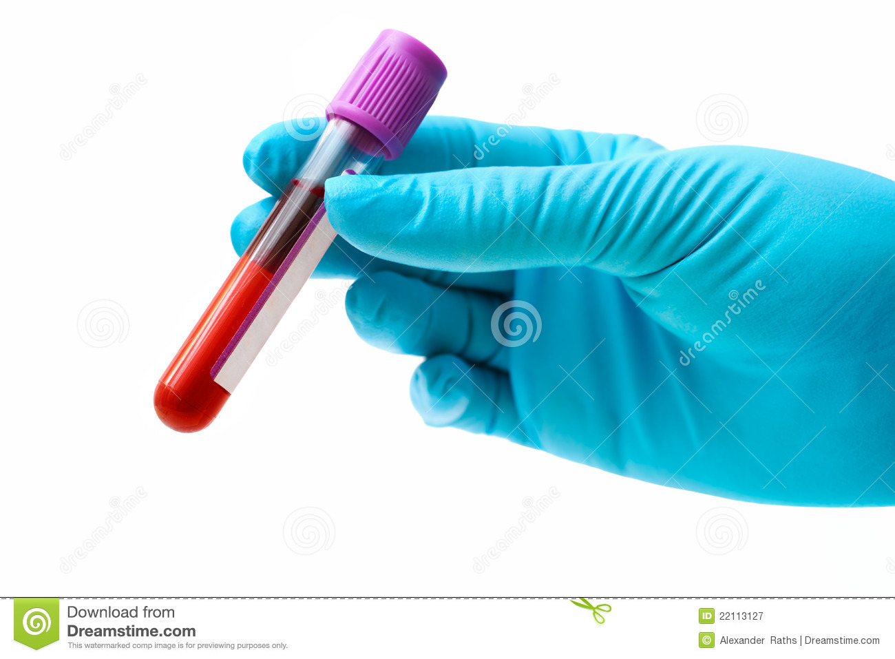 Blood Test Royalty Free Stock Photography   Image  22113127