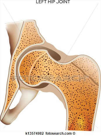 Clip Art Of Hip Joint K13574982   Search Clipart Illustration Posters