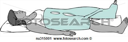 Clipart   Woman Lying Down Encased In A 1 1 2 Hip Spica Immobilization