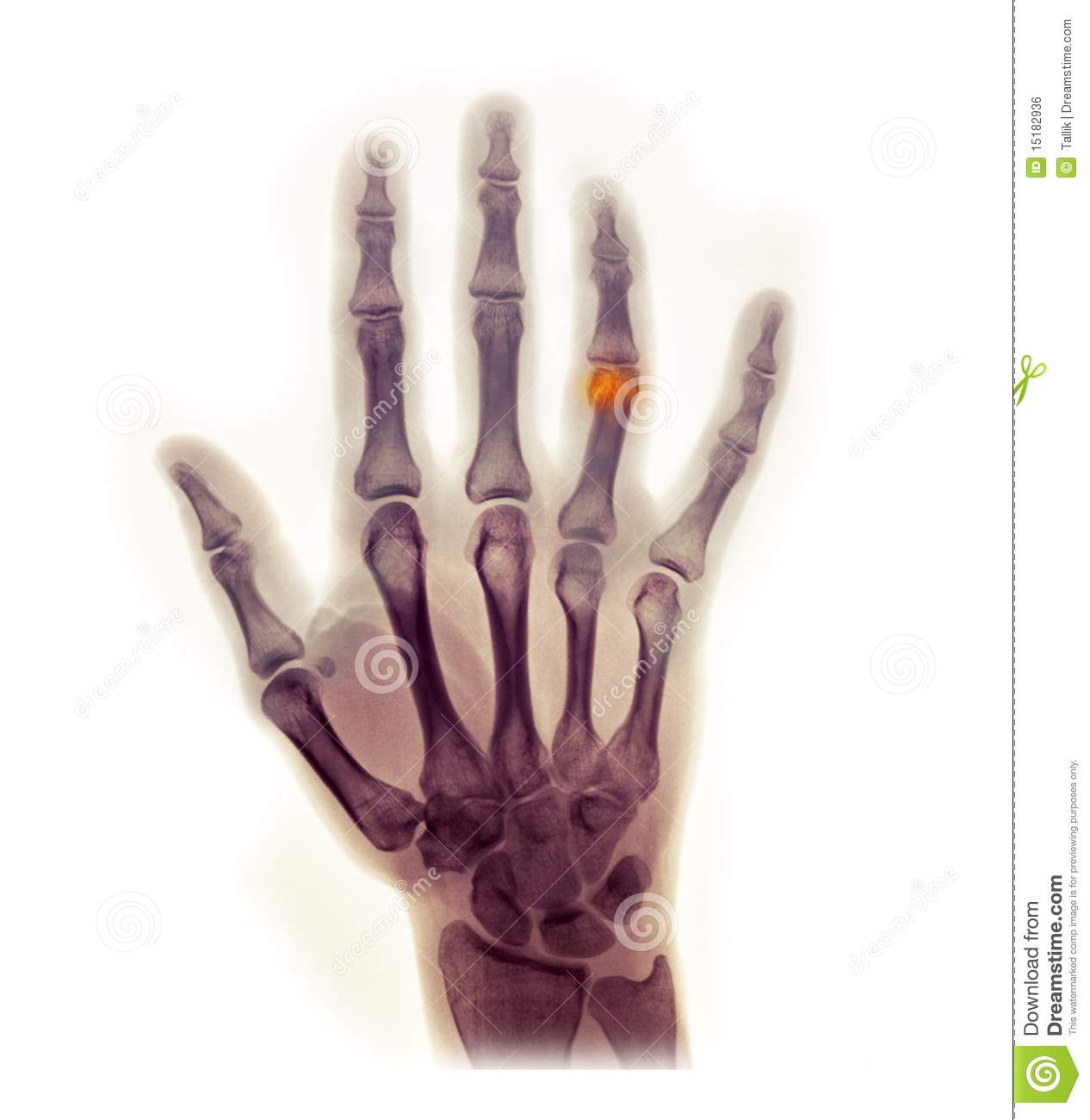 Displaying 20  Images For   Hand X Ray Clipart