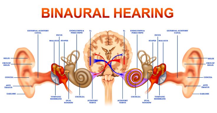 Binaural Hearing   Hearing Loss Infographics   Pinterest   Hearing    