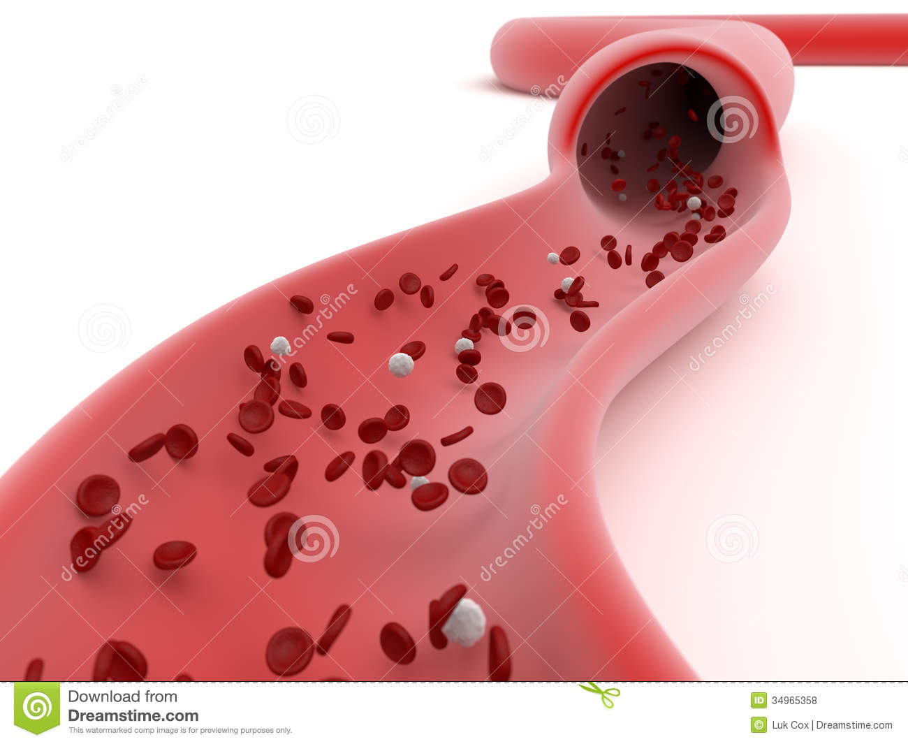 Blood Vessels Clipart View Of A Blood Vessel Sliced