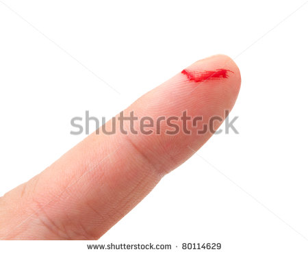 Bleeding Finger Clipart Bleeding From The Cut Finger