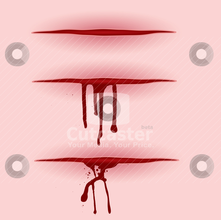 Blood Cut Bleeding Stock Vector Clipart Three Illustrated Open Wounds