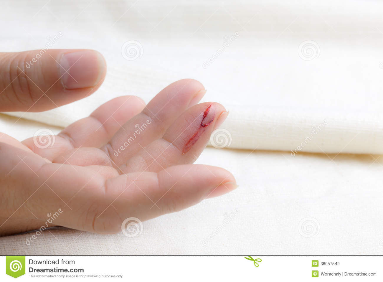 Injured Finger Royalty Free Stock Images   Image  36057549