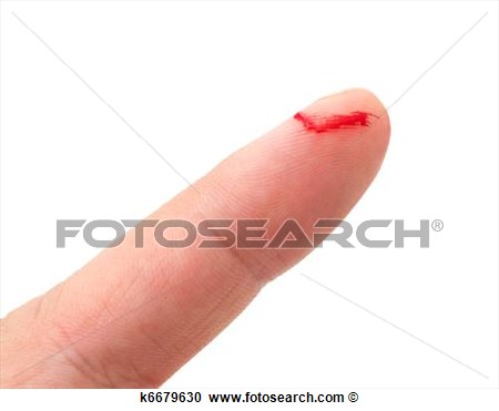 Stock Photography   Bleeding From The Cut Finger  Fotosearch   Search