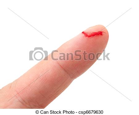 Stock Photography Of Bleeding From The Cut Finger Isolated On White