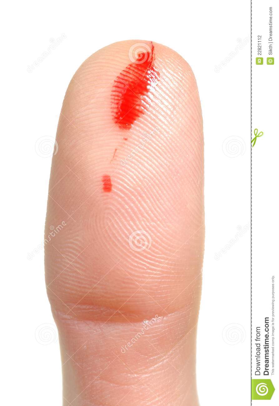 Thumb With Blood Coming From A Cut Against A White Background 