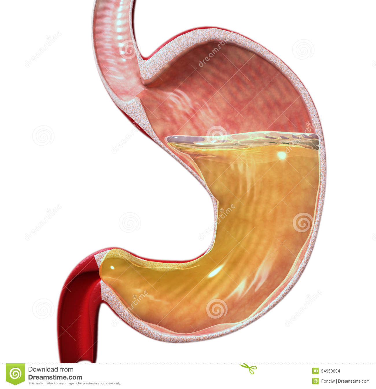 3d Human Stomach With Hydrochloric Acid