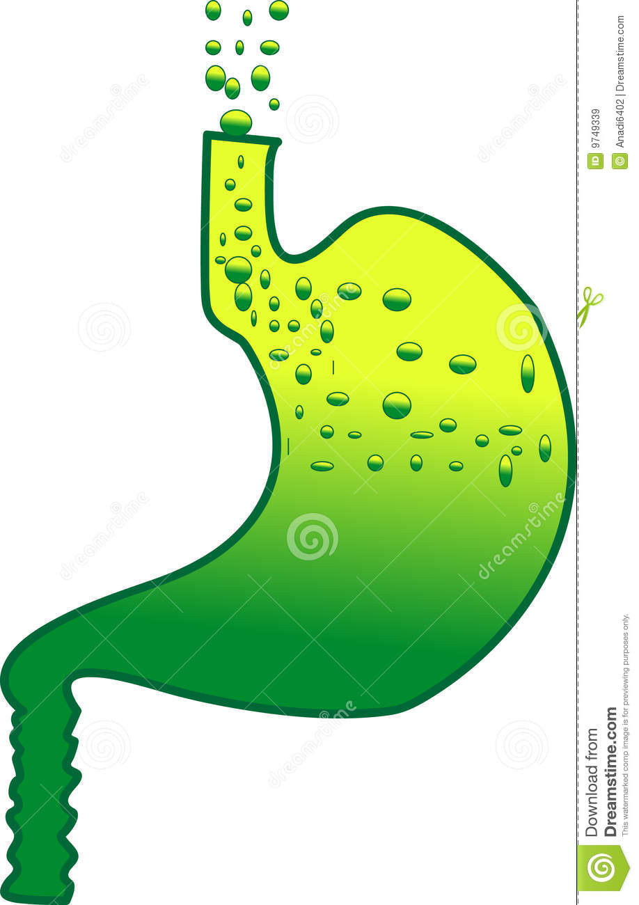 Stomach With Hyper Acidity Having Flatulence Bubbles And Bloating Of    