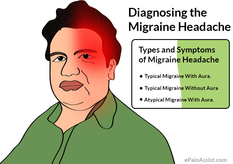 Migraine Headaches Symptoms Symptoms And Signs Of Migraine