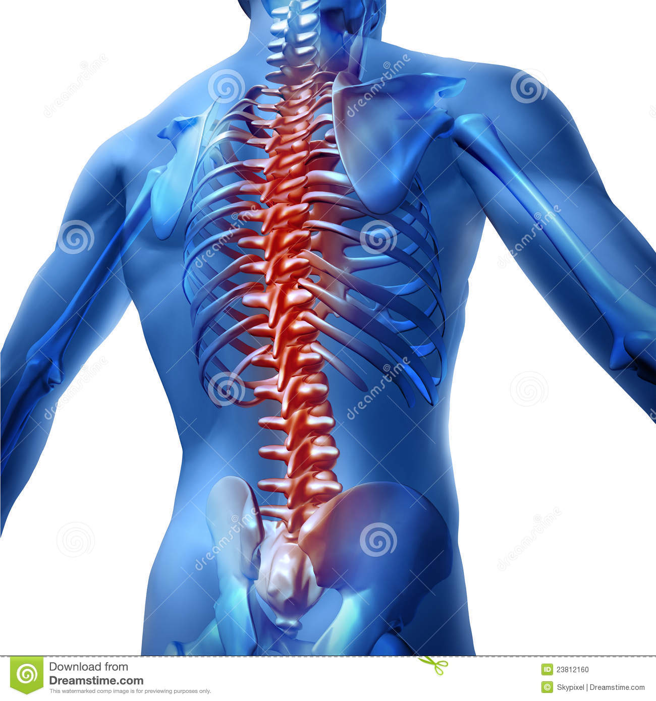 Human Body Backache And Back Pain With An Upper Torso Body Skeleton