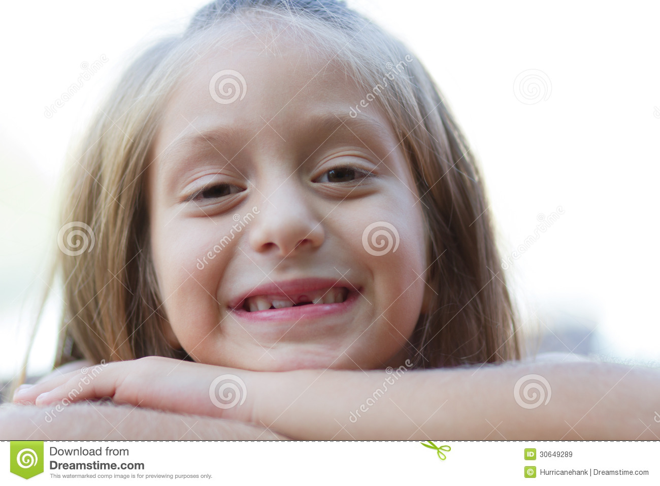Funny Toothless Little Girl Royalty Free Stock Images   Image