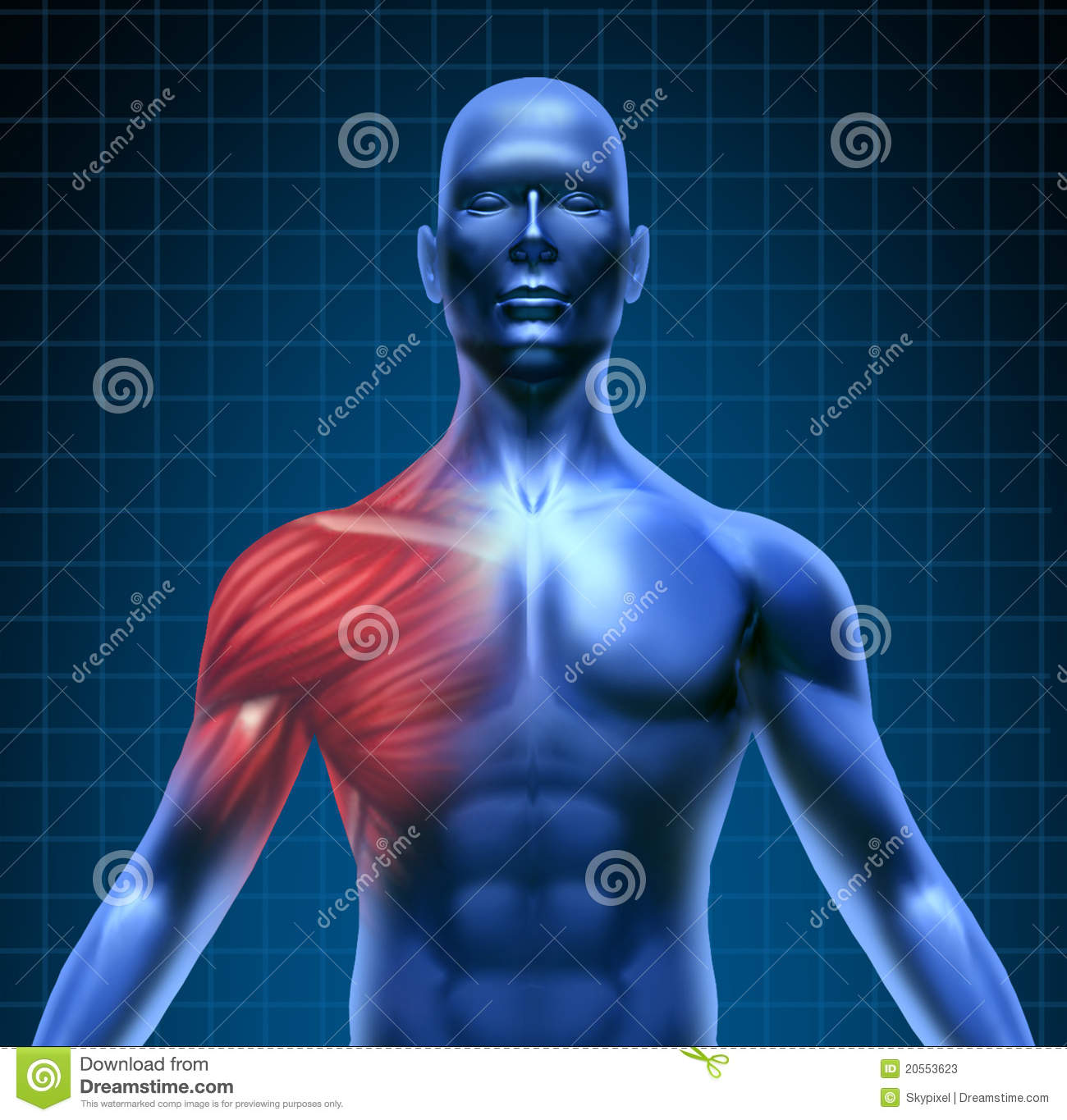 Muscle Pain Represented By A Blue Human Concept With The Red Shoulder    