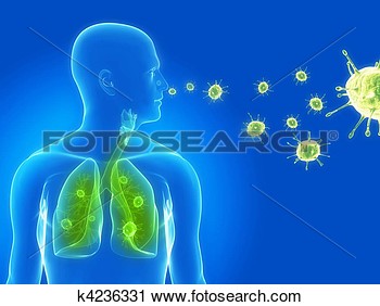 Clipart   Virus Infection   Fotosearch   Search Clip Art Illustration