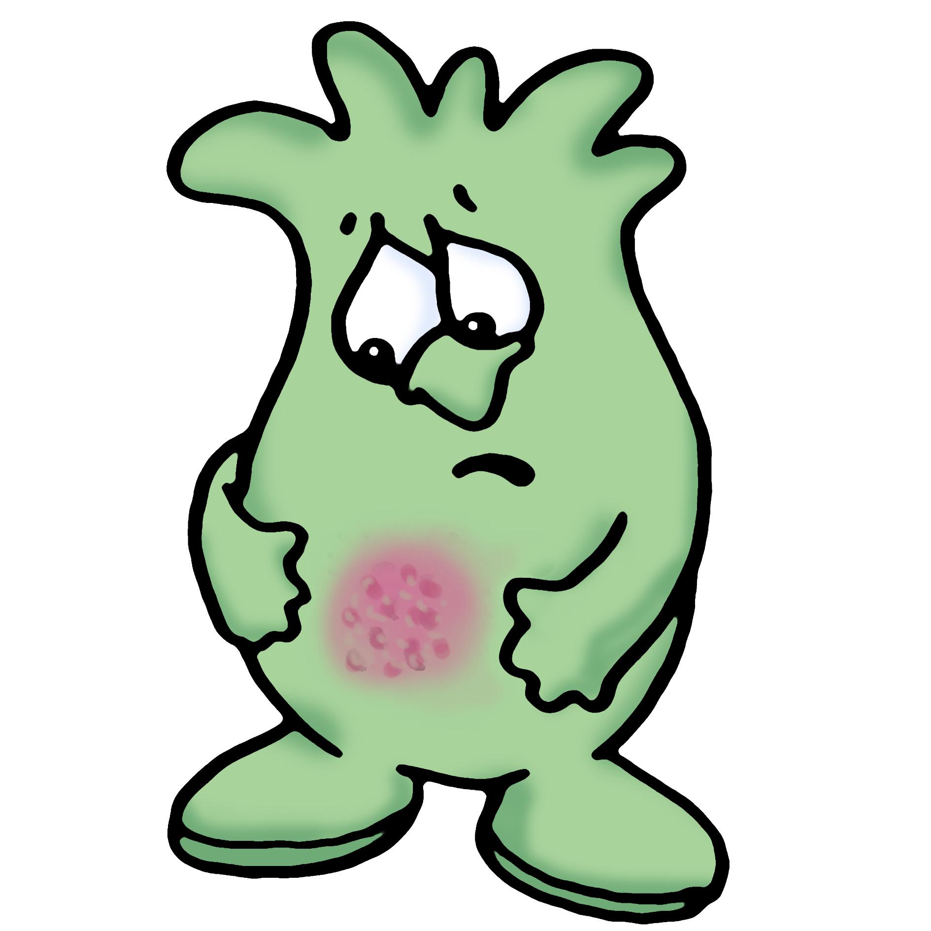 Kidney Infection Has Proved To Infection Stock Imagery Clipart Than