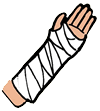 Broken Arm In Cast   Clipart Panda   Free Clipart Images