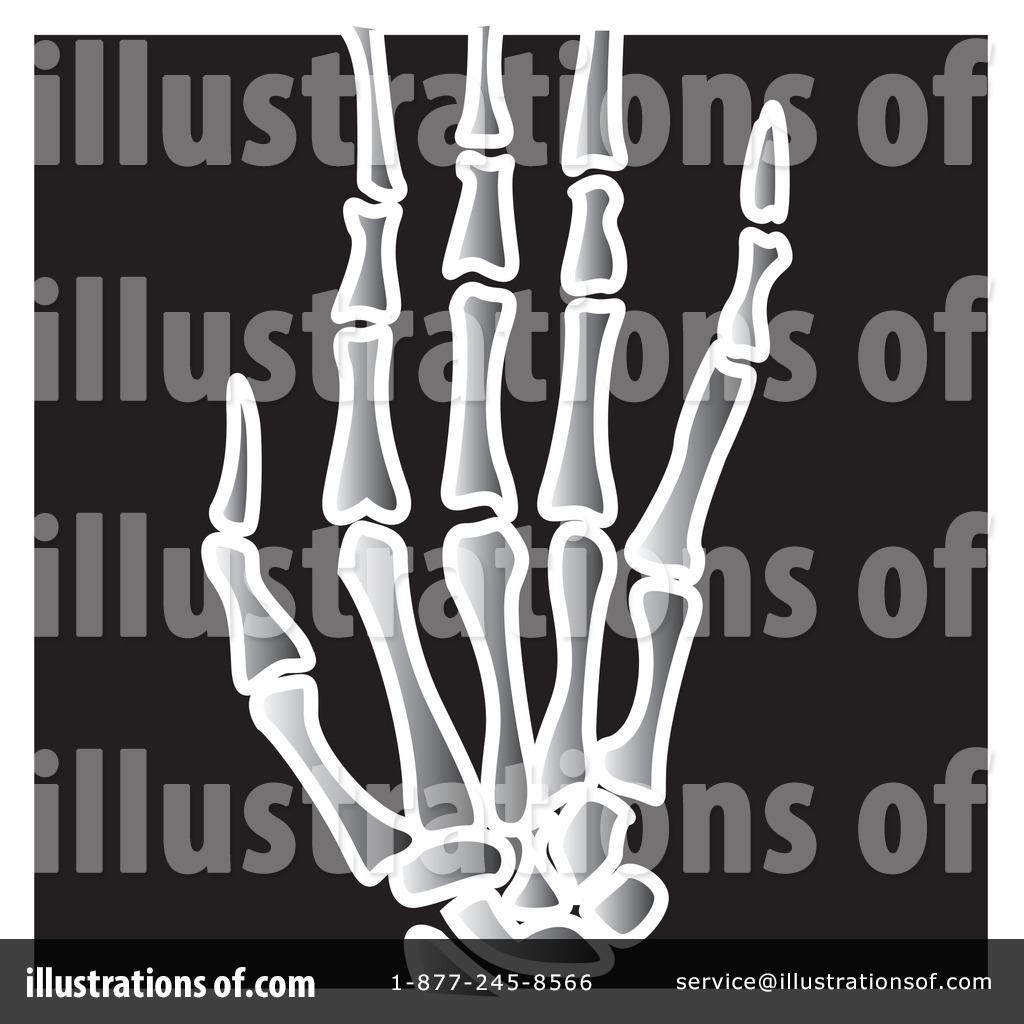 Ray Clipart Black And White Royalty Free  Rf  Xray Clipart