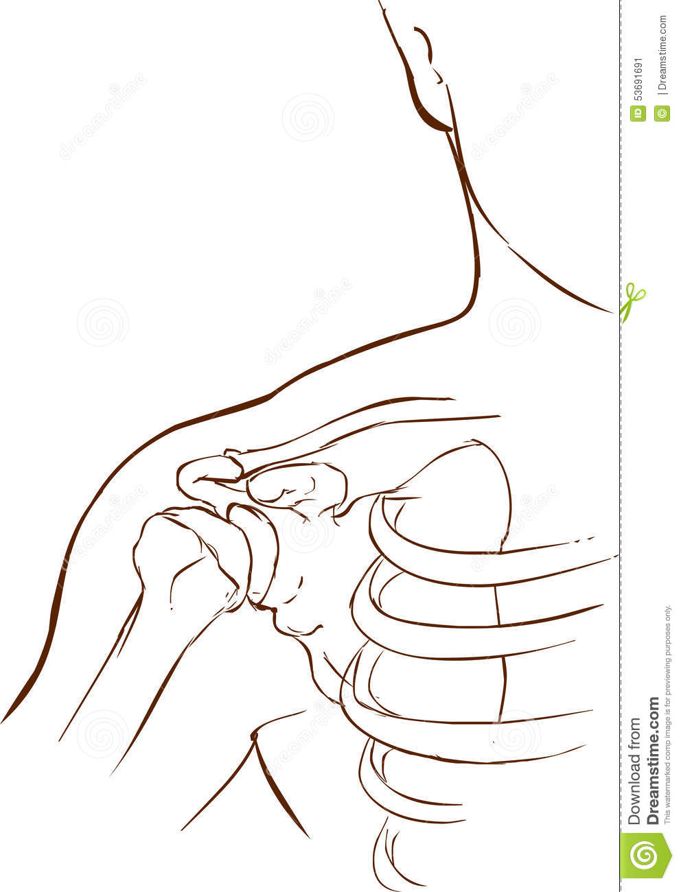 Stock Illustration  Shoulder Dislocation