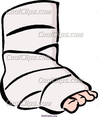 Ankle Clipart Broken