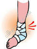 Broken Ankle Clipart Clip Art Illustrations Images Graphics And