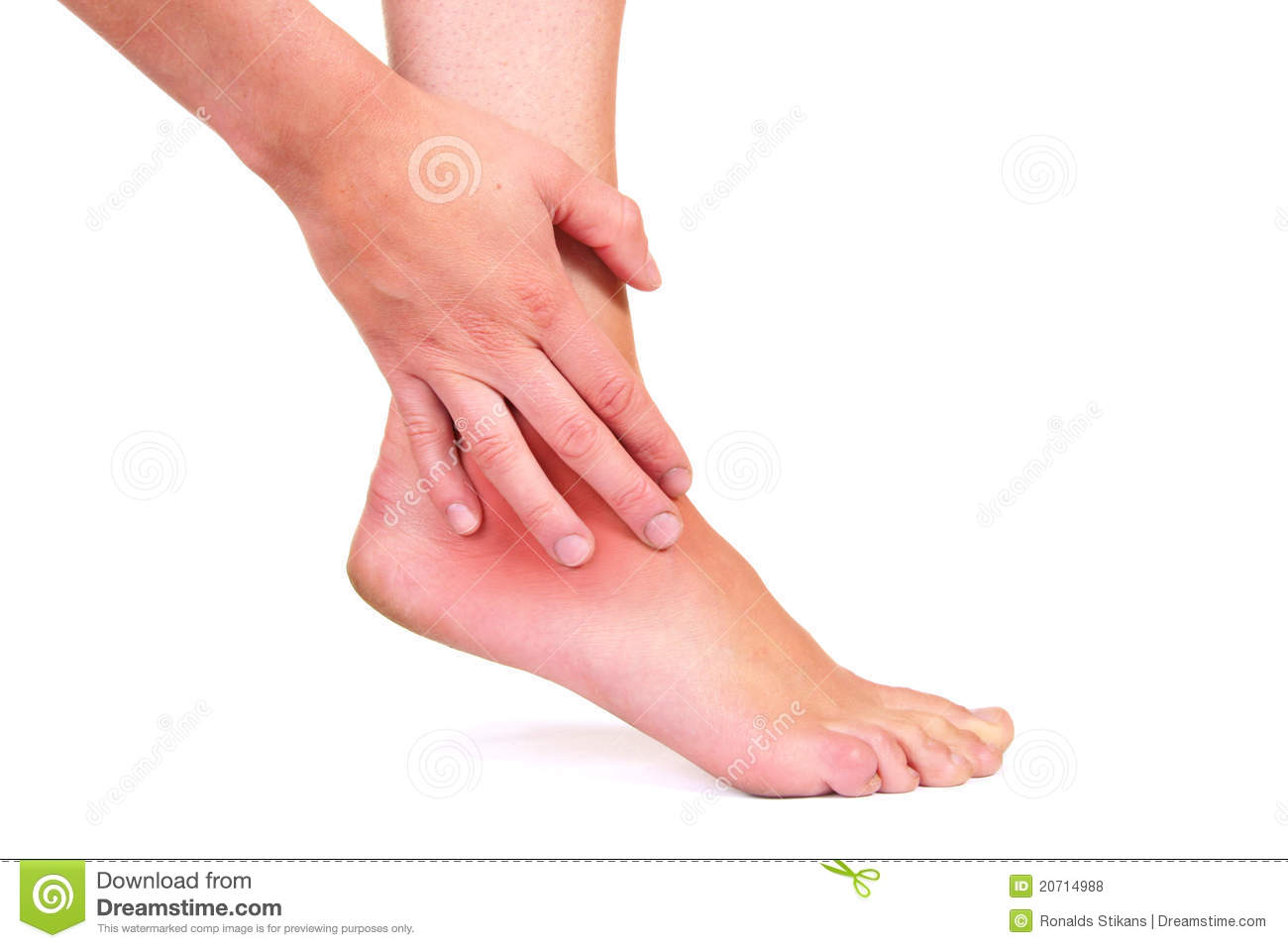 Sprained Ankle Clipart Injured Ankle Isolated On