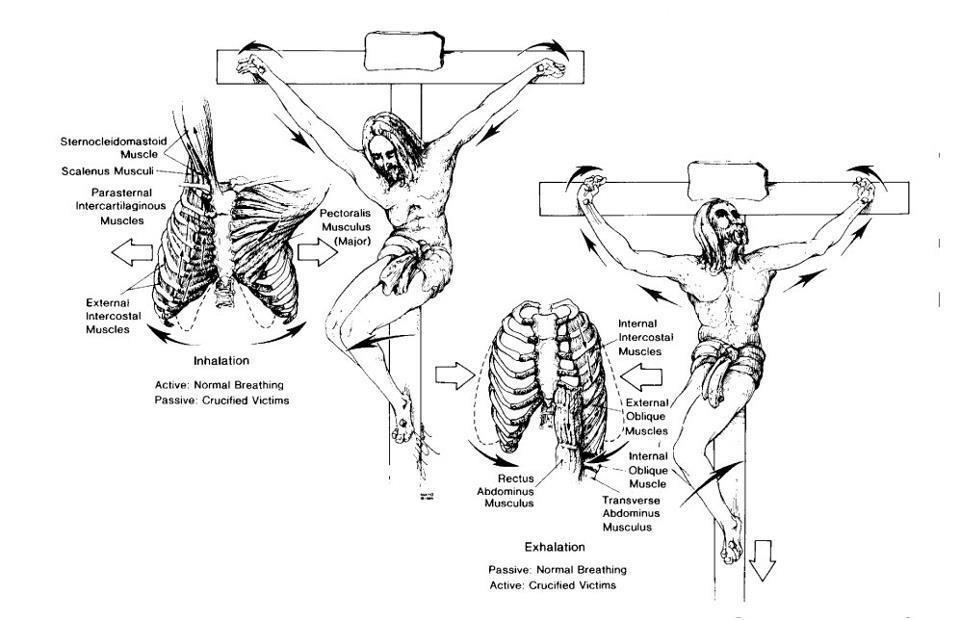 The Anatomical And Physiological Details Of Death By Crucifixion By Dr