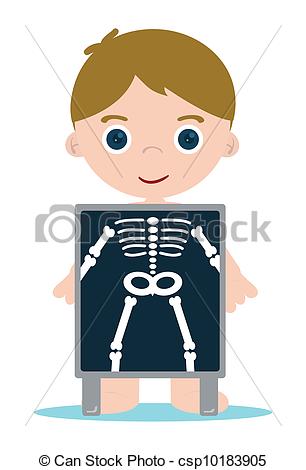 Vector Clipart Of X Ray Bones Kid   X Ray Check Bones Kid Csp10183905