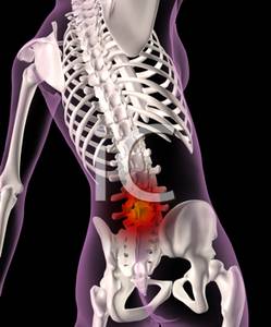 With Highlighted Lower Back Injury   Royalty Free Clipart Picture