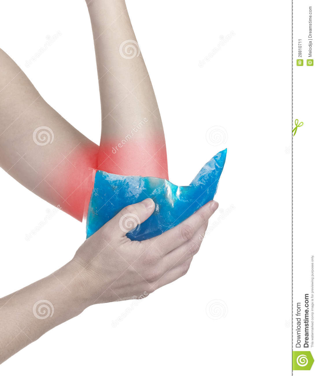 Cool Ice On A Swollen Hurting Elbow Medical Concept Photo  Isolation
