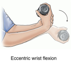 Wrist Flexion And Extension Exercises Wrist Flexion Png
