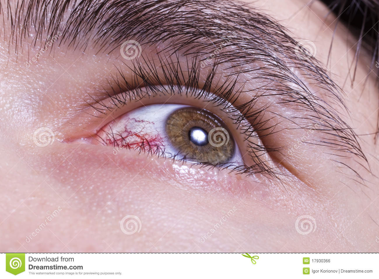 Green Men Eye With Red Blood Vessels Royalty Free Stock Image   Image