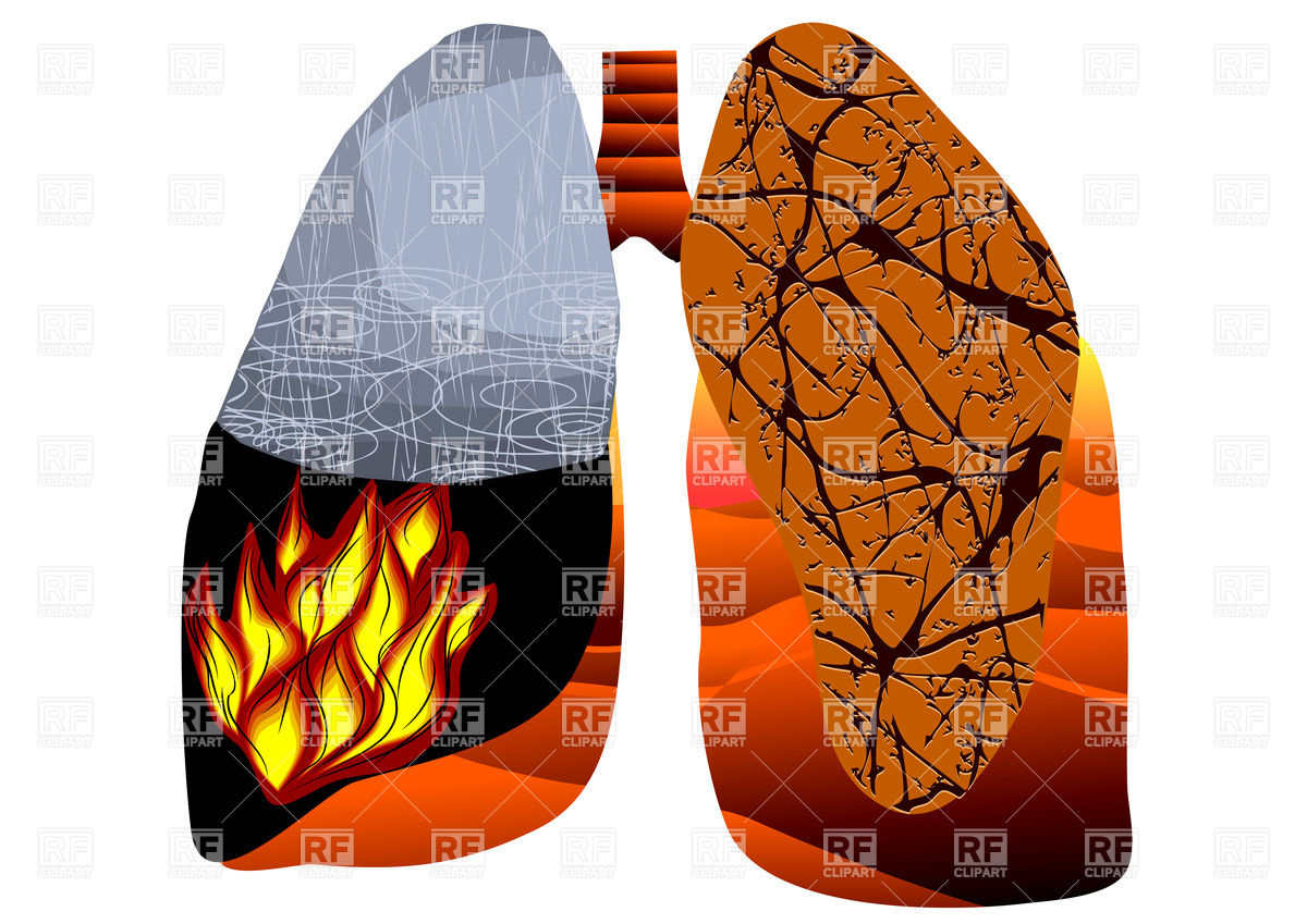     Human Lungs Of Smoker Download Royalty Free Vector Clipart  Eps