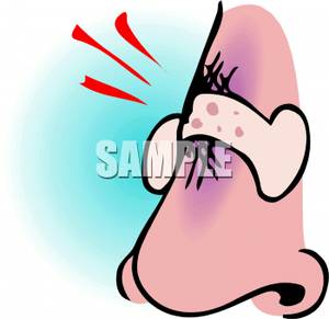 Broken Nose   Royalty Free Clipart Picture