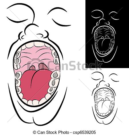 Clipart Vector Of Mouth With Metal Dental Fillings   An Image Of A
