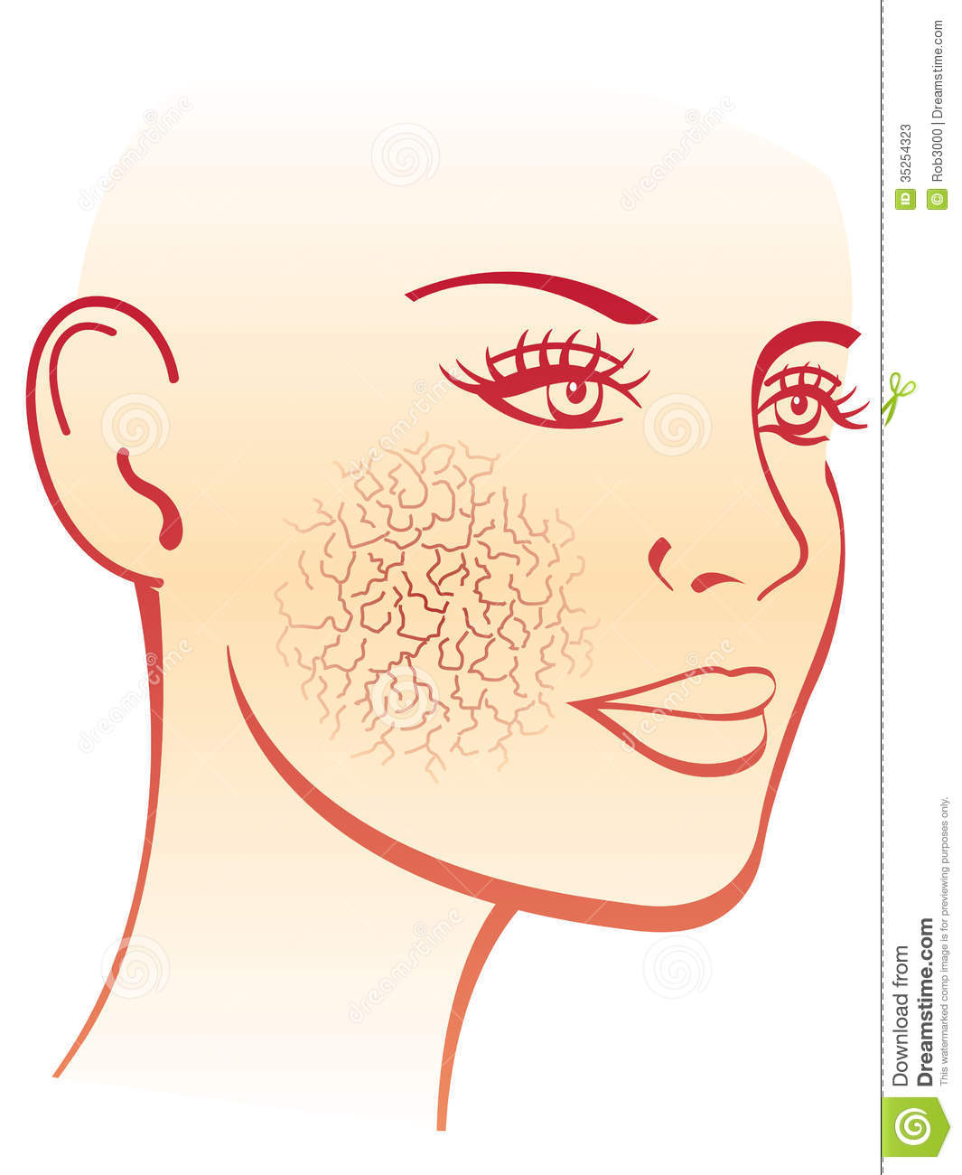 Simbolic Medical Illustration Of The Effects Of Dry Skin