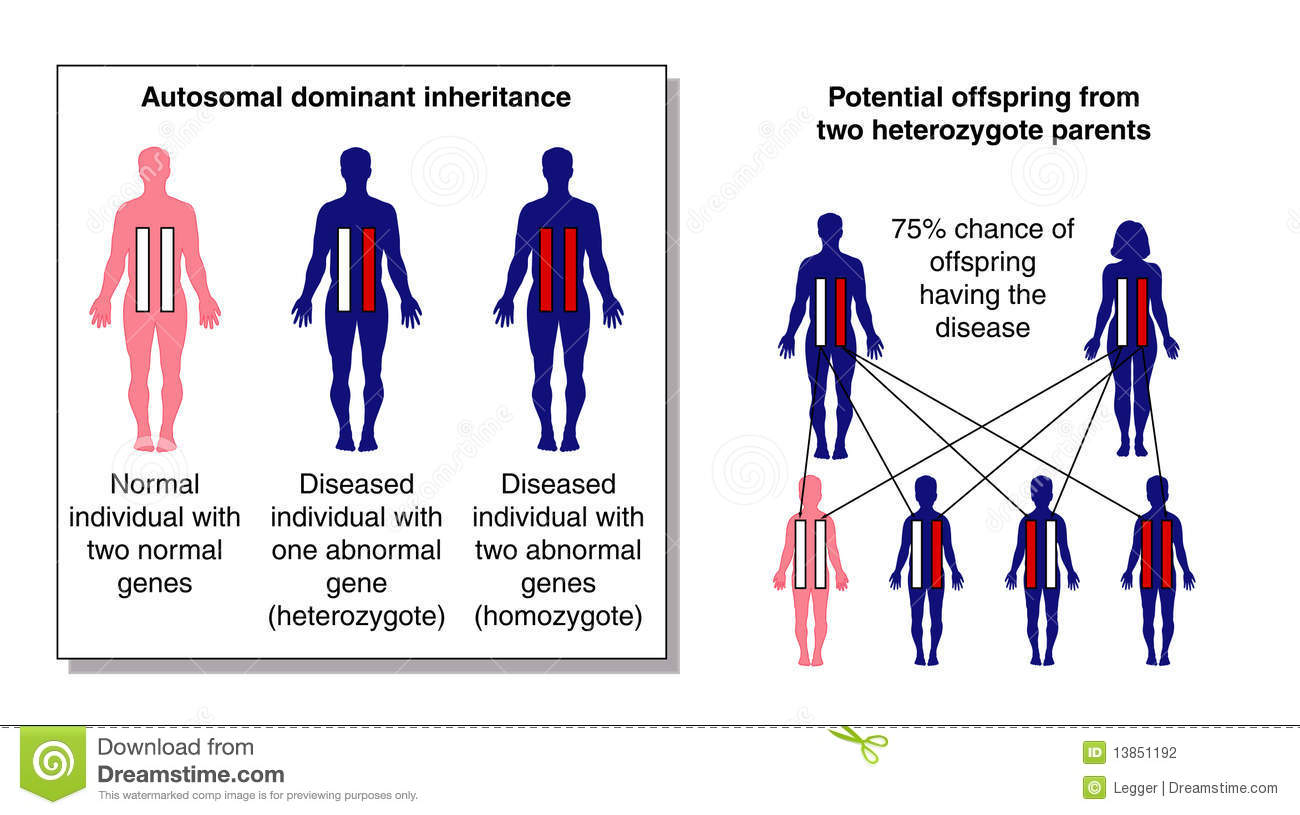 Diagram Of Dominant Inheritance Showing The Likelihood Of Diseased    