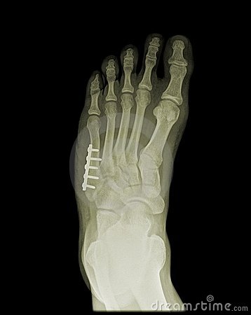 Orthopedic Surgeon Clipart Orthopedic Surgery Human Foot     