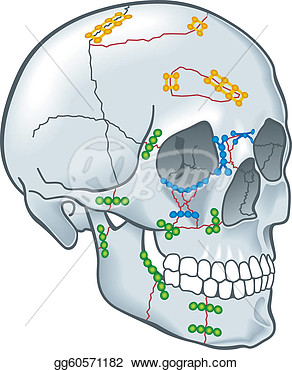 Stock Illustration   Cranial Surgery  Clipart Drawing Gg60571182