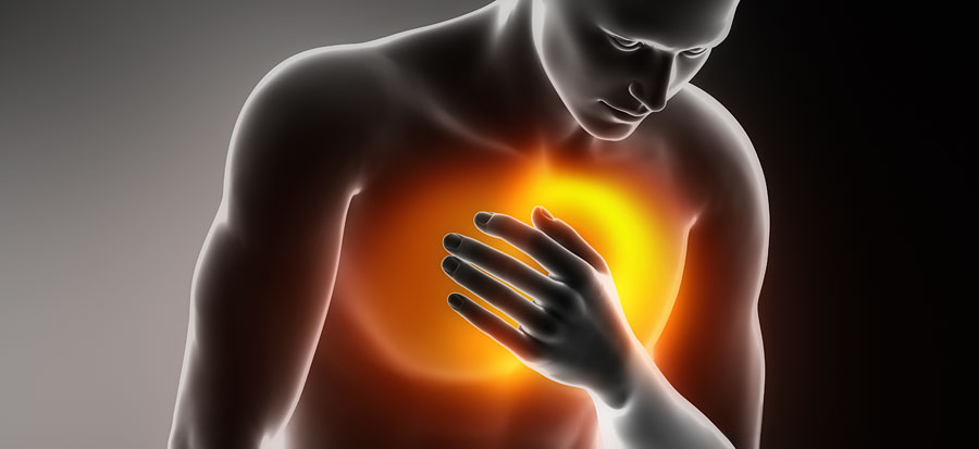 Herzinfarkt Symptome   Die Typischen Symptome Eines Myokardinfarkts